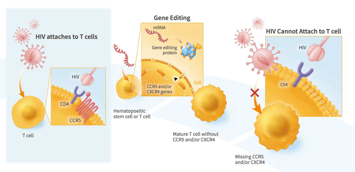 Gene-Editing Therapies for HIV