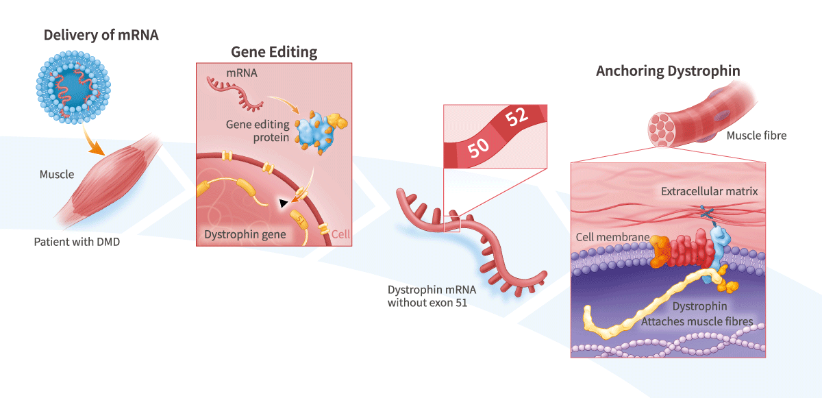Gene-Editing Therapies for Duchenne Muscular Dystrophy (DMD)