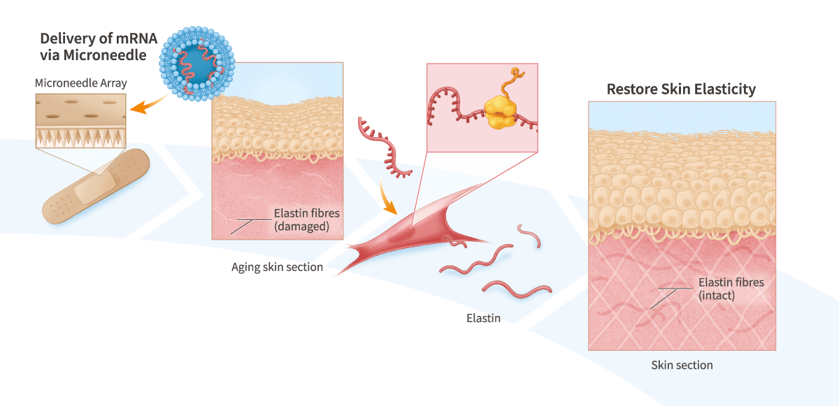 mRNA Delivery to Skin